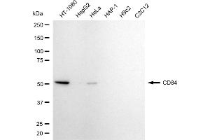 Western blotting analysis using CD84 antibody (ABIN7797983).