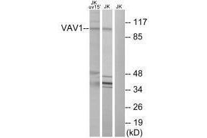 Western blot analysis of extracts from Jurkat cells, using VAV1 (Ab-174) antibody. (VAV1 抗体  (Tyr174))