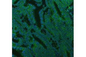 IF analysis of SEC22B using anti-SEC22B antibody (ABIN7602121).