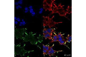 Immunocytochemistry/Immunofluorescence analysis using Mouse Anti-Alpha B Crystallin Monoclonal Antibody, Clone 1A7. (CRYAB 抗体  (APC))