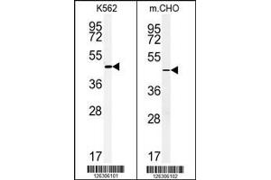 (LEFT)Western blot analysis of ENTPD8 Antibody in K562 cell line lysates (35ug/lane). (ENTPD8 抗体  (C-Term))