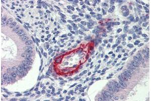 Uterus, Human: Formalin-Fixed, Paraffin-Embedded (FFPE) (DDAH2 抗体  (N-Term))