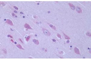 Human Brain, Cortex: Formalin-Fixed, Paraffin-Embedded (FFPE) (GPR6 抗体  (Cytoplasmic Domain))