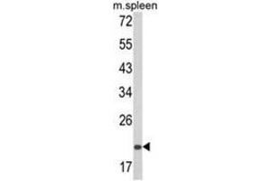 Western blot analysis of PSMA7 Antibody (Center) in mouse spleen tissue lysates (35ug/lane). (PSMA7 抗体  (Middle Region))
