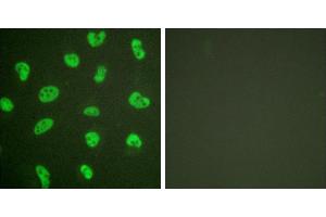 Forskolin + -Immunofluorescence analysis of HeLa cells, treated with Forskolin (40nM, 30mins), using DNA-PK antibody. (PRKDC 抗体)