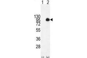 Western Blotting (WB) image for anti-Mucin 20, Cell Surface Associated (MUC20) antibody (ABIN2995265) (MUC20 抗体)