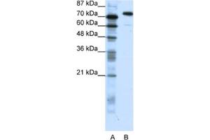Western Blotting (WB) image for anti-SATB Homeobox 1 (SATB1) antibody (ABIN2461672) (SATB1 抗体)