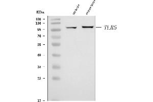 Western blot analysis of Tlr5 using anti-Tlr5 antibody (ABIN7602531).