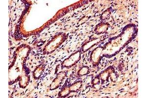 Immunohistochemistry of paraffin-embedded human pancreatic tissue using ABIN7151870 at dilution of 1:100 (EPH Receptor B6 抗体  (AA 410-553))