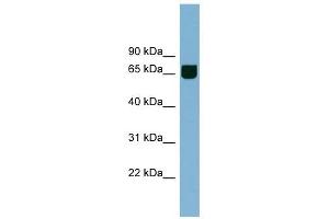 RIC8B antibody used at 1 ug/ml to detect target protein. (RIC8B 抗体)