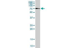 CHEK2 MaxPab rabbit polyclonal antibody. (CHEK2 抗体  (AA 1-543))
