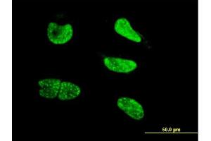 Immunofluorescence of monoclonal antibody to NEUROG3 on HeLa cell. (Neurogenin 3 抗体  (AA 1-101))