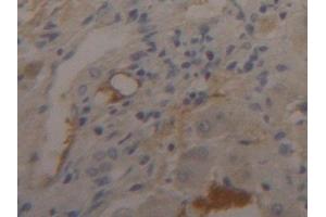 Detection of FGB in Human Liver Tissue using Polyclonal Antibody to Fibrinogen Beta Chain (FGB) (Fibrinogen beta Chain 抗体  (AA 29-491))