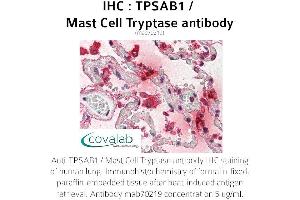 Image no. 1 for anti-Tryptase alpha/beta 1 (TPSAB1) antibody (ABIN1723158) (TPSAB1 抗体)