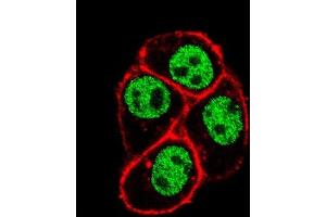 Confocal immunofluorescent analysis of CDC73 Antibody (Center) (ABIN653128 and ABIN2842707) with Hela cell followed by Alexa Fluor 488-conjugated goat anti-rabbit lgG (green). (HRPT2 抗体  (AA 132-161))