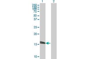 Western Blot analysis of SSNA1 expression in transfected 293T cell line by SSNA1 MaxPab polyclonal antibody. (SSNA1 抗体  (AA 1-119))