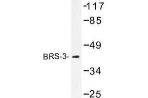 Image no. 1 for anti-Bombesin-Like Receptor 3 (BRS3) antibody (ABIN317729) (BRS3 抗体)