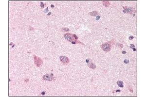 Immunohistochemistry (IHC) image for anti-Amyloid beta (A4) Precursor Protein (APP) (AA 18-289) antibody (ABIN317496) (APP 抗体  (AA 18-289))