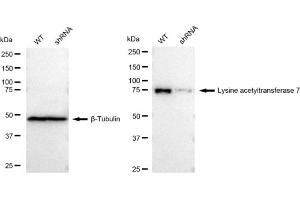 Western blotting analysis using Lysine acetyltransferase 7 antibody (ABIN7799528). (Recombinant MYST2 抗体)