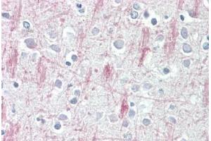 Human Brain, Cortex: Formalin-Fixed, Paraffin-Embedded (FFPE) (GPR125 抗体  (AA 1098-1109))