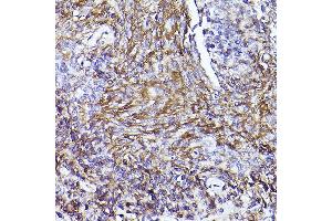 Immunohistochemistry of paraffin-embedded human placenta using [KO Validated] CD73/NT5E Rabbit pAb (ABIN3022733, ABIN3022734, ABIN3022735, ABIN1513283 and ABIN6219201) at dilution of 1:50 (40x lens). (CD73 抗体  (AA 290-550))