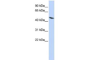 WB Suggested Anti-TEKT4 Antibody Titration: 0. (Tektin 4 抗体  (N-Term))