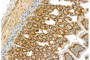 ABIN6265767 and ABIN6278388 at 1/100 staining Rat colon tissue by IHC-P. (TSG101 抗体  (Internal Region))