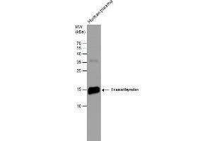 WB Image Human tissue extract (30 μg) was separated by 15% SDS-PAGE, and the membrane was blotted with Transthyretin antibody [N1C3] , diluted at 1:500. (TTR 抗体)