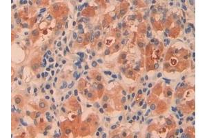 Detection of CTH in Human Stomach Tissue using Polyclonal Antibody to Cystathionine (CTH) (Cystathionine (AA 163-382) 抗体)