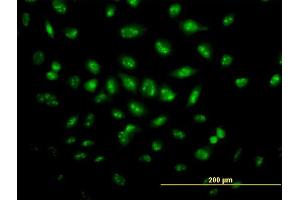 Immunofluorescence of monoclonal antibody to TP53RK on HeLa cell. (TP53RK 抗体  (AA 154-253))