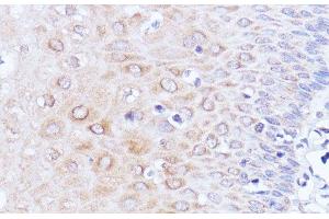 Immunohistochemistry of paraffin-embedded Human esophageal using Polyclonal AntibodyPC1 Polyclonal Antibody at dilution of 1:100 (40x lens). (PC1 抗体)