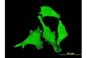 Immunofluorescence of monoclonal antibody to ANKRD17 on HeLa cell. (ANKRD17 抗体  (AA 2501-2603))