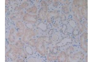 DAB staining on IHC-P; Samples: Human Kidney Tissue. (BMP10 抗体  (AA 315-424))