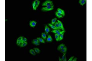 Immunofluorescence staining of HepG2 cells with ABIN7157984 at 1:66, counter-stained with DAPI. (Mip (AA 220-263) 抗体)