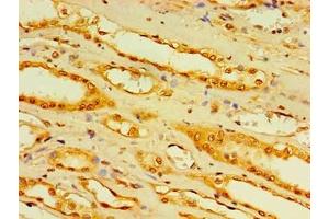 Immunohistochemistry of paraffin-embedded human kidney tissue using ABIN7158862 at dilution of 1:100 (DCP2 抗体  (AA 1-385))