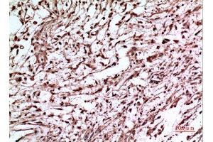 Immunohistochemistry (IHC) analysis of paraffin-embedded Human Brain, antibody was diluted at 1:100. (p53 抗体  (Tyr216))