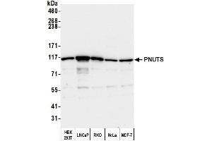 Western Blotting (WB) image for anti-Protein Phosphatase 1, Regulatory (Inhibitor) Subunit 10 (PPP1R10) (AA 350-400) antibody (ABIN7454630)