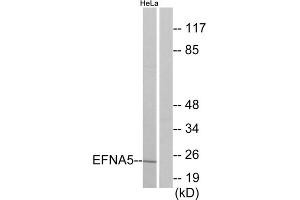 Western blot analysis of extracts from HeLa cells, using EFNA5 antibody. (Ephrin A5 抗体  (Internal Region))