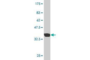 Western Blotting (WB) image for anti-Testis-Specific serine Kinase 2 (TSSK2) (AA 265-358) antibody (ABIN565133)