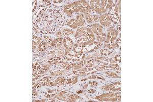 Immunohistochemical analysis of (ABIN391830 and ABIN2841673) on paraffin-embedded Human kidney tissue. (HSP70 1A 抗体  (AA 19-48))