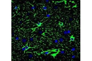 Confocal immunofluorescent analysis of GFAP antibody with brain tissue followed by Alexa Fluor 488-conjugated goat anti-mouse lgG (green). (GFAP 抗体)