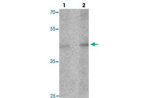 Western blot analysis of LMX1A in rat brain tissue with LMX1A polyclonal antibody  at (1) 1 and (2) 2 ug/mL.