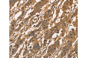 Immunohistochemistry (IHC) image for anti-Capping Protein (Actin Filament) Muscle Z-Line, alpha 3 (CAPZA3) antibody (ABIN2429679)