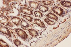 Anti-Beclin 1 Picoband antibody,  IHC(P): Rat Intestine Tissue (Beclin 1 抗体  (AA 1-354))