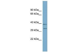 DPPA4 antibody used at 1 ug/ml to detect target protein. (DPPA4 抗体  (N-Term))