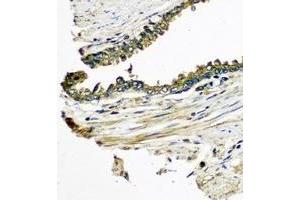 Immunohistochemical analysis of CXCL11 staining in human prostate formalin fixed paraffin embedded tissue section.