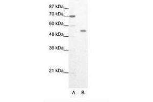 Image no. 1 for anti-Zinc Finger Protein 665 (ZNF665) (AA 76-125) antibody (ABIN202995) (ZNF665 抗体  (AA 76-125))