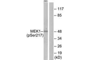 anti-Mitogen-Activated Protein Kinase Kinase 1/2 (MAP2K1/2) (AA 189-238), (pSer218) antibody
