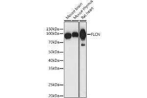 Western blot analysis of extracts of various cell lines, using FLCN antibody (ABIN7267226) at 1:1000 dilution. (FLCN 抗体  (AA 1-130))