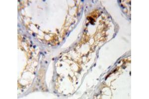 Used in DAB staining on fromalin fixed paraffin-embedded Testis tissue (KIAA1524 抗体  (AA 230-560))